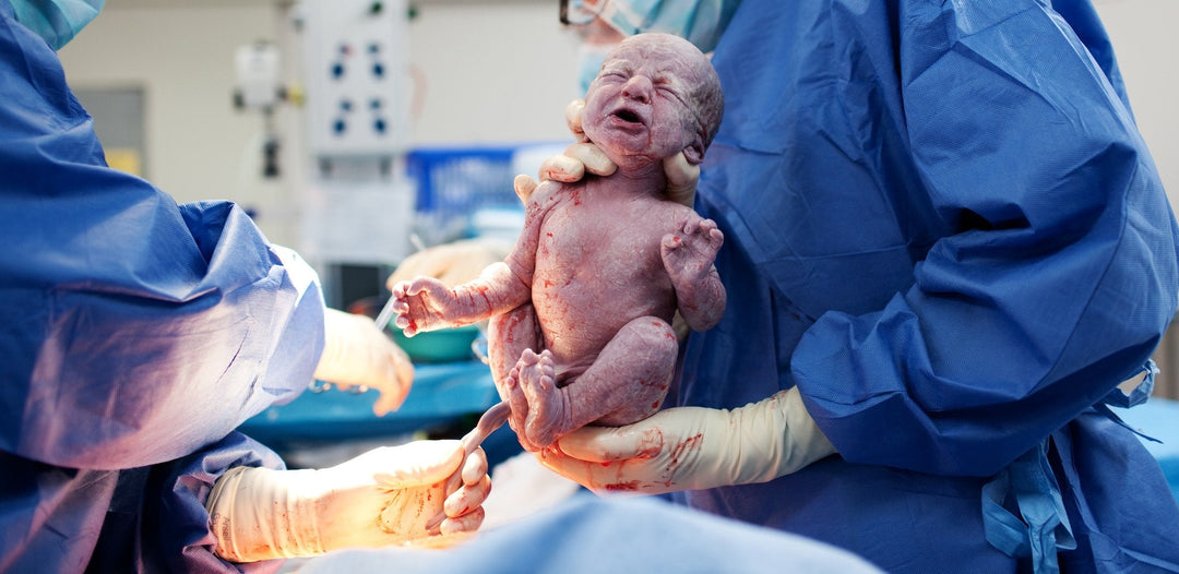 Navigating a Planned Caesarean: Integrative Strategies for Preparation, Healing & Microbiome Support
